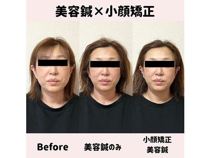 ワッカ 広尾(WACCA)の写真