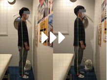 ミライズ整体院 三宮本院/事例【30代男性・姿勢】