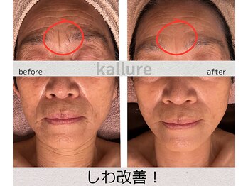 カリュール(K'allure)/若見え！