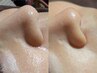 《19時以降》翌日の化粧ノリがレベチ！翌日デートも◎美肌と小顔フェイシャル