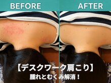 ターコイズ(Turquoise)/デスクワークで肩こり！