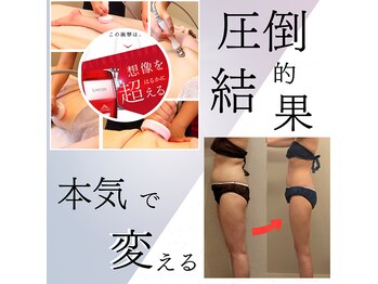 ラブリエ(Labriller)