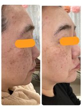 オリーブ(Olive)/