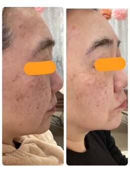 オリーブ(Olive)/