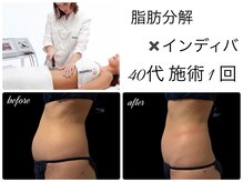 エルール トータルビューティ(Aileure total beauty)