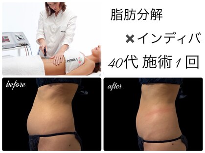 エルール トータルビューティ(Aileure total beauty)の写真