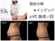 エルール トータルビューティ(Aileure total beauty)の写真