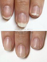 マリーロール 梅田店(Marie Laure)/自爪育成/深爪矯正/ネイルケア