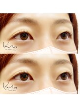 クレー(Klee)/パリジェンヌラッシュリフト