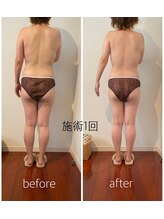 バンブー(bamboo)/ビフォーアフター