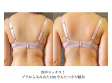 エミニナル(EMININAL)/【バストケア】ビフォーアフター