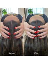 ブレア(BLAIR)/脳洗浄ヘッドスパ