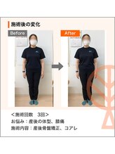 ただき接骨院 整体院 高崎本院/お悩み：産後の体型崩れ、膝痛