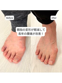 はやと整体院/50代女性(腰痛)