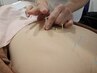 【慢性的な不調が気になる方に】刺絡療法・鍼オーダーメイドで調整☆30分