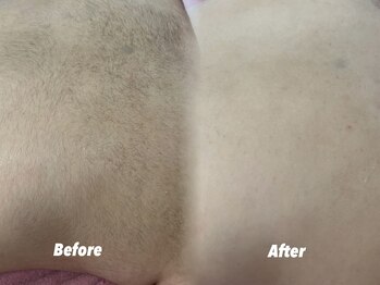 クイーン 渋谷店(QUEEN)/男性のボディーケア