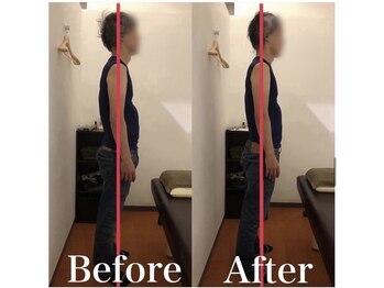 カワル整体 上通り院/その不調の原因、吸いすぎかも