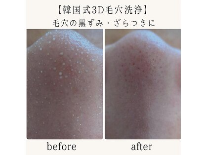 グレース(grace)の写真