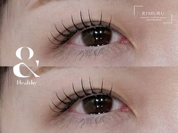 リムル バイ グリッター 吉沢店(RIMURU by GLITTER)/&Healthy（アンドヘルシー）