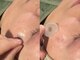 クレア(CLEA)の写真/機械を使わないしみとりで素肌美へ！話題のサロン☆