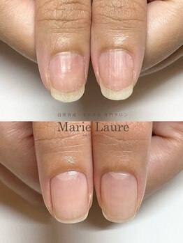 マリーロール 梅田店(Marie Laure)/自爪育成/深爪矯正/ネイルケア