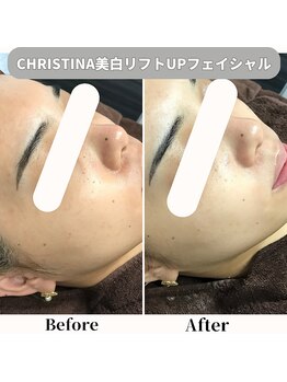 ヘアティブ アンド スキンベイビー 名古屋金山店(Hairtive&Skin Baby)の写真/白く透明感のある美肌に導く★《毎月5名限定！小顔リフトアップフェイシャル60分¥6,800♪》金山駅スグ！