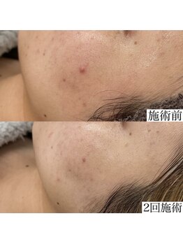 ヴェルシック(Belchic)/毎日のメイクが楽しい肌へ