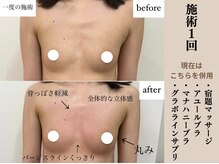 ソワ(soie)/痩せ型さんもバストアップ！