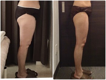 美容整体ウェリナ 名駅院/小顔矯正/骨盤矯正/美脚サロン