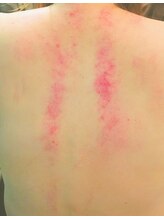 イニティウム 清澄白河(initium)/【スライドカッピング】