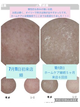 メナードフェイシャルサロン 石山/継続が楽しくなるお手入れ