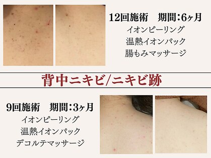 アクール(Accueil)の写真