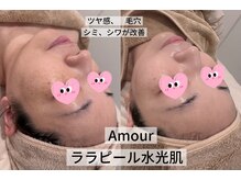 アムール(Amour)/ララピール水光肌
