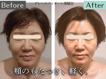 グレースフィオーレ 南越谷店(gracefiore)