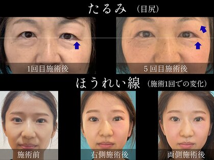 ネクスフィット(Nexfit)の写真