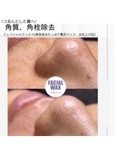 セレーノ(Sereno)/ただの脱毛じゃない