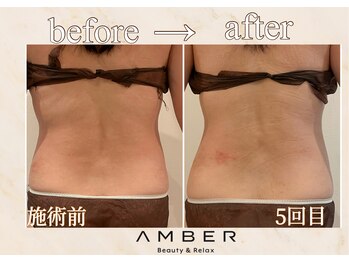 アンバー 恵比寿(AMBER)/無理なく綺麗に痩せたい