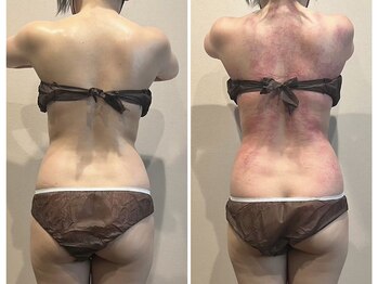 マイティー整骨院 ココア(CoCoa)/セルクラ