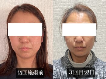 エール(aile)/たまには癒されたい！