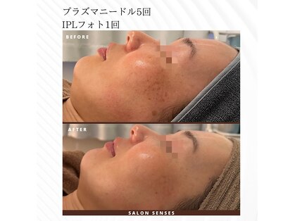 センシズ(Senses)の写真