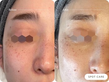 キュレイテッドスキン(CURATED SKIN)/