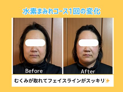 ヨサパーク ミュウ ヨシムラテン(YOSA PARK MIU)の写真
