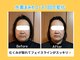 ヨサパーク ミュウ ヨシムラテン(YOSA PARK MIU)の写真