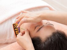 アロマプラス鍼灸院/メンズ美容鍼