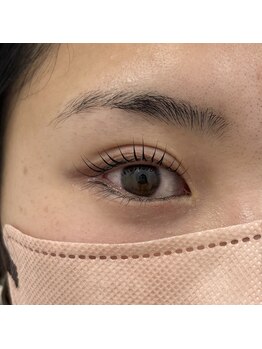 レジアント(Rediant)/