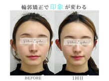 プルチャームエクイデム(Pulchram equidem)/ヘッドスパ+頭蓋骨矯正+小顔矯正