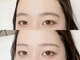 ホワイトアイ 茶屋町(WHITE EYE)の写真