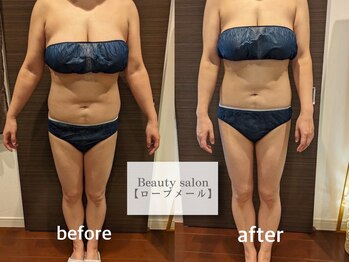 ローブメール(Robemail)/ビフォーアフター