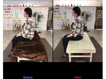 ストレチックス 近江八幡店/BeforeAfter