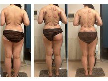 オーシャンブルーム 目黒(OceanBloom)/リンパマッサージハイパーナイフ